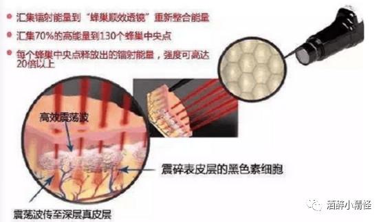 皮秒超皮秒激光區(qū)別