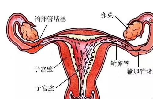 輸卵管不孕的最佳治療方法與高速方案規(guī)劃——領航款48.13.17，迅速處理解答問題_C版27.663