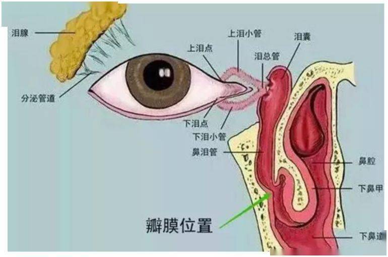 淚道堵塞用什么眼藥水最有效